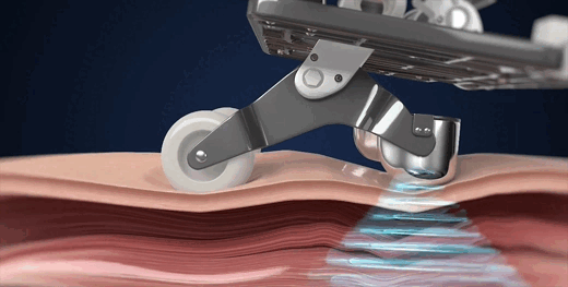 công nghệ massage sóng âm sonic wave